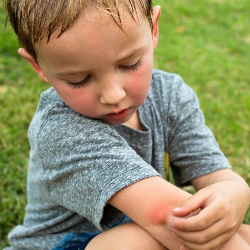 Decoding Your Itch: Bed Bug vs. Mosquito, Flea, Ant, and Spider Bites